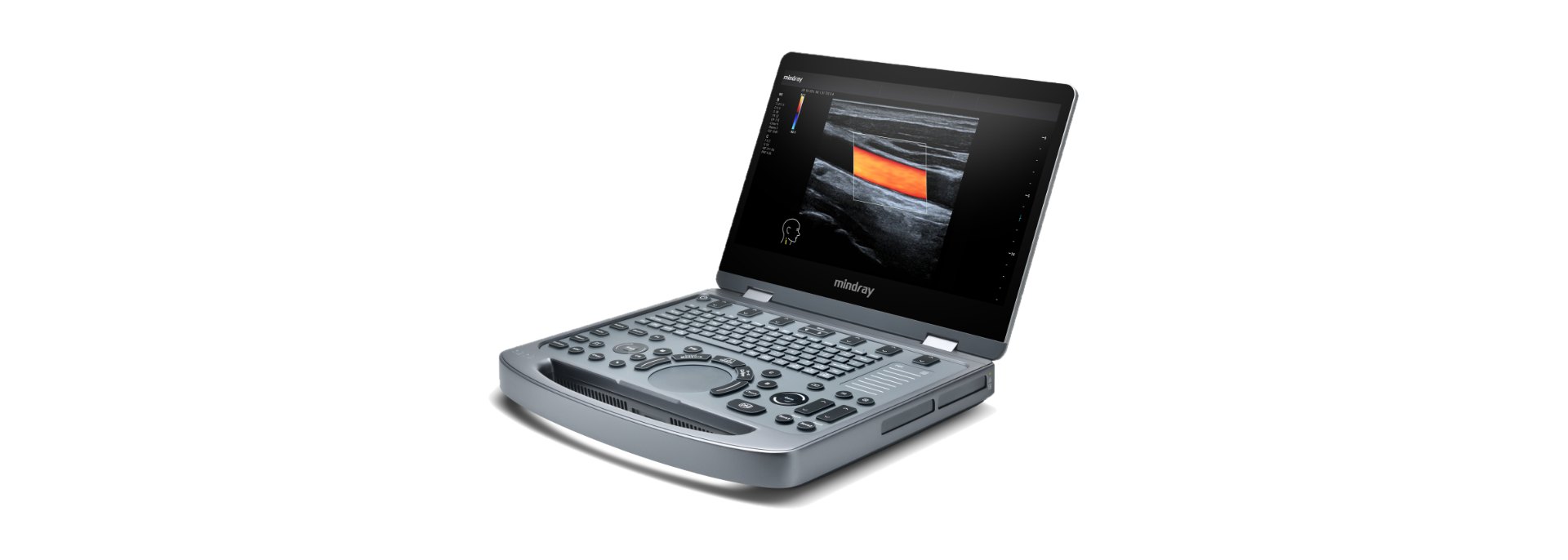 Mindray MX3